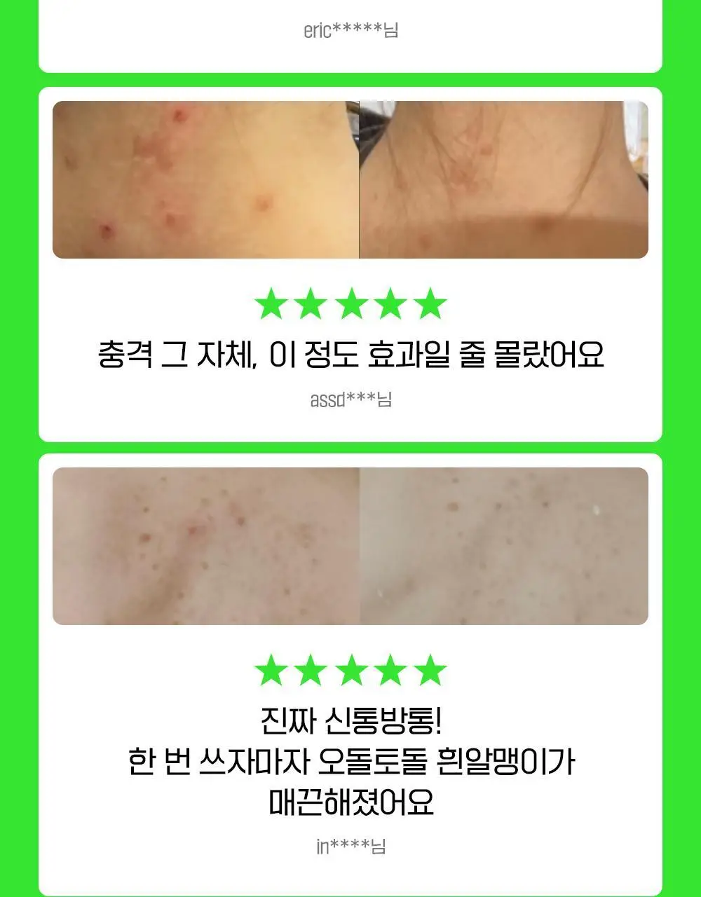[화해1위] 파티온 노스카나인 트러블 바디워시 490ml 상세페이지 6